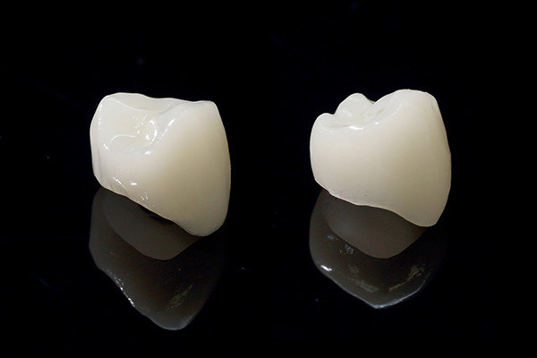 短期間で美しい歯が作れる「CAD/CAMシステム」を導入